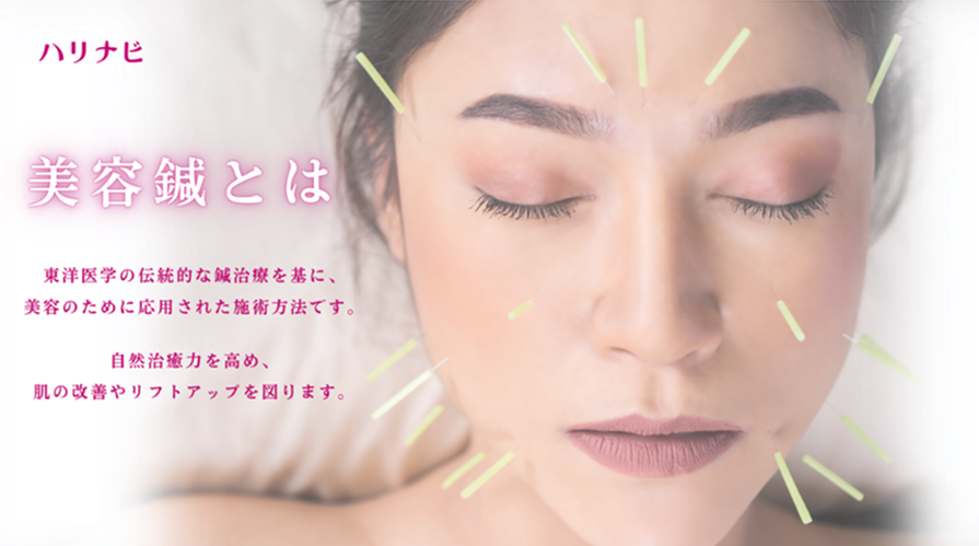 美容鍼とは